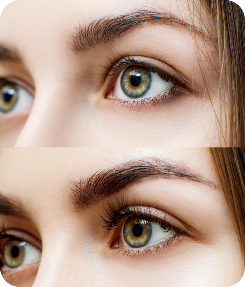 starlash